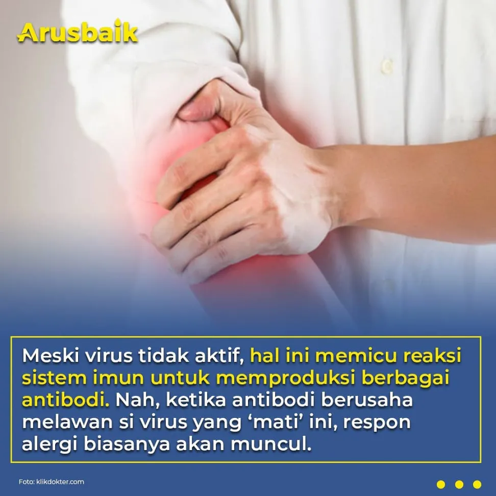 Kenapa Lengan Nyeri Setelah Disuntik? Ini Penjelasannya